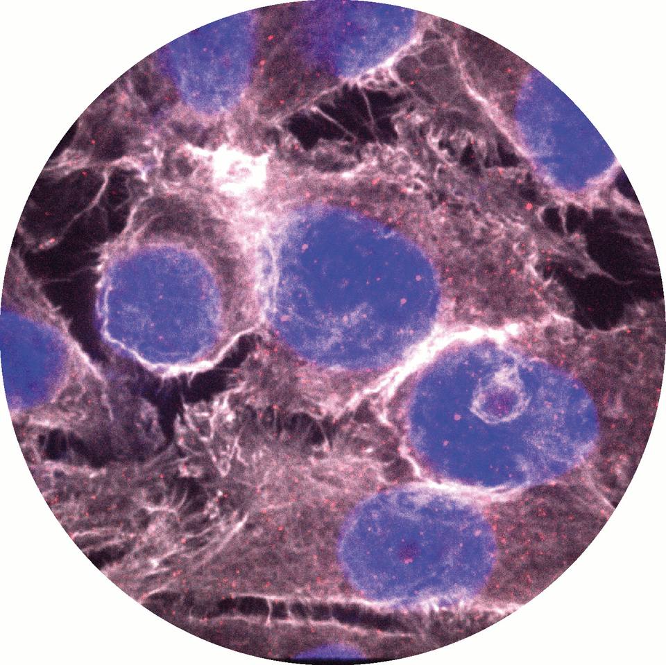 Cancer Research UK Lung Cancer Centre of Excellence (CRUK LCCE) Conference 2026